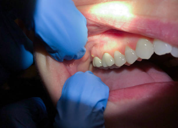 Best Urgent Dental Care for Toothaches in Rock Port, MO